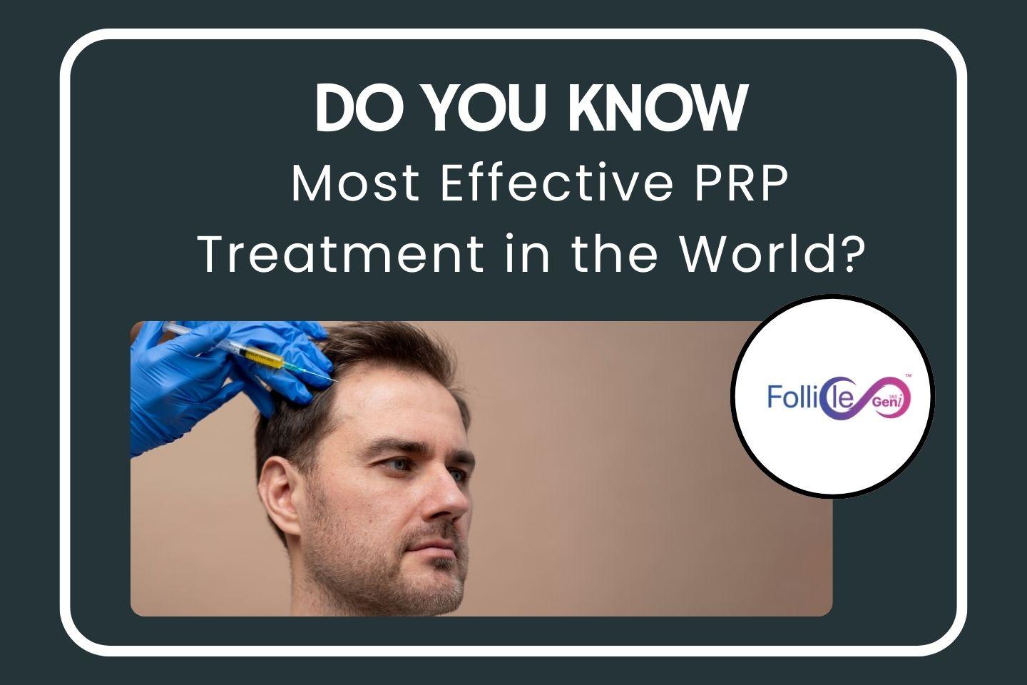 Do You Know the Most Effective PRP Treatment in the World?