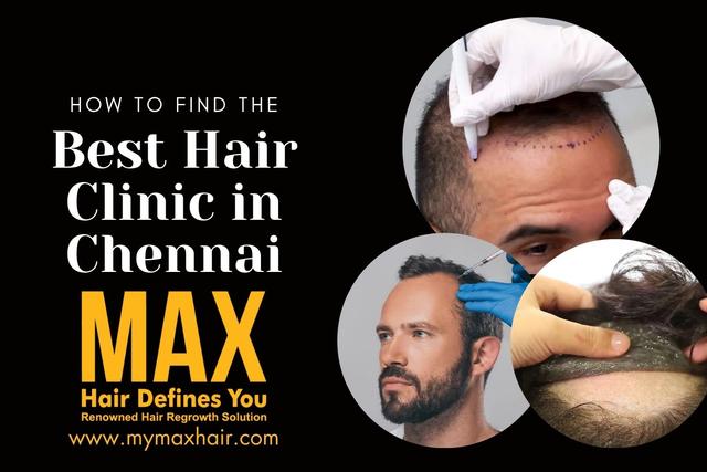 How to Find the Best Hair Clinic in Chennai Image