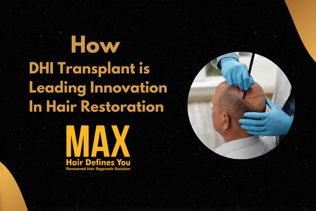 How DHI Transplant is Leading Innovation in Hair Restoration Image