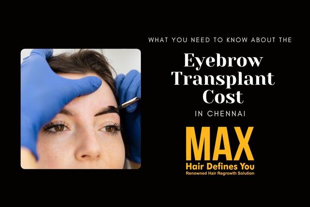 What You Need to Know About the Eyebrow Transplant Cost in Chennai Image