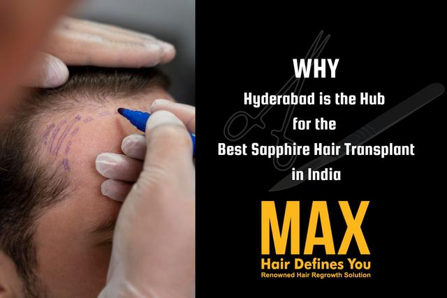 Why Hyderabad is the Hub for the Best Sapphire Hair Transplant in India Image