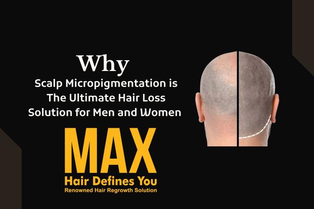 Why Scalp Micropigmentation is The Ultimate Hair Loss Solution for Men and Women Image