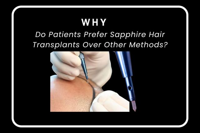 Why Do Patients Prefer Sapphire Hair Transplants Over Other Methods? Image