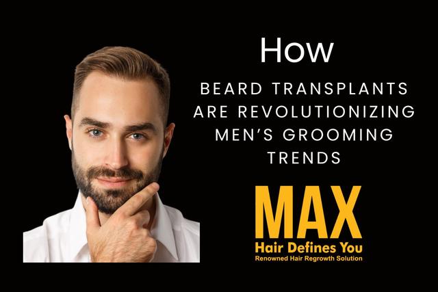 How Beard Transplants Are Revolutionizing Men’s Grooming Trends Image