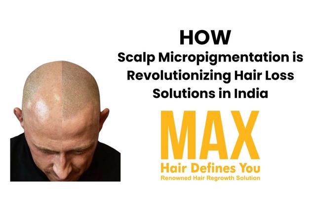 How Scalp Micropigmentation is Revolutionizing Hair Loss Solutions in India Image