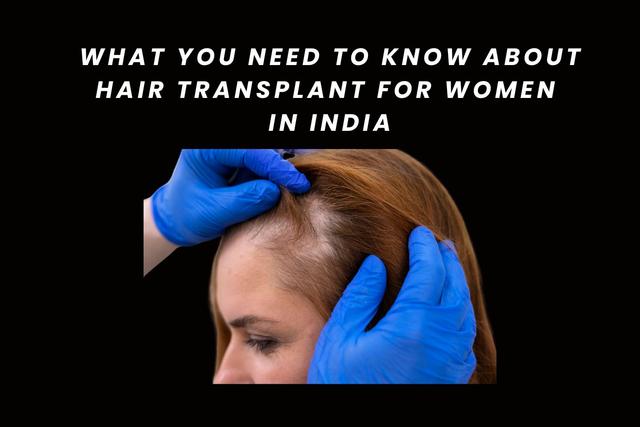 What You Need to Know About Hair Transplant for Women in India Image