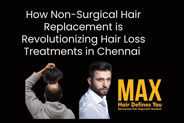 How Non-Surgical Hair Replacement is Revolutionizing Hair Loss Treatments in Chennai Image