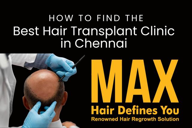 How to Find the Best Hair Transplant Clinic in Chennai Image