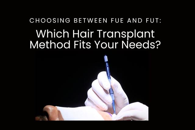 Choosing Between FUE and FUT: Which Hair Transplant Method Fits Your Needs Image