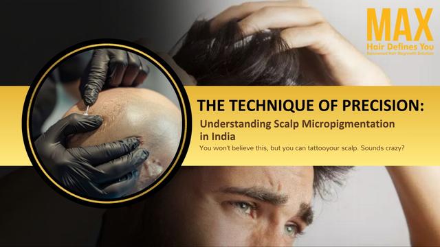 The Technique of Precision: Understanding Scalp Micropigmentation in India Image