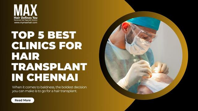 Top 5 Best Clinics for Hair Transplant in Chennai Image
