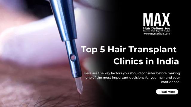 Top 5 Hair Transplant Clinics in India Image