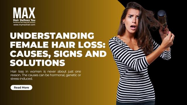 Understanding Female Hair Loss: Causes, Signs and Solutions Image