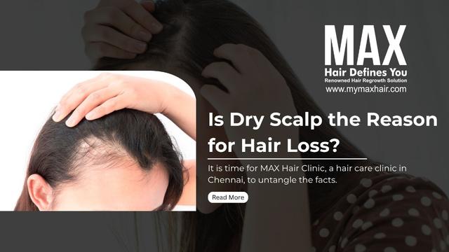 Is Dry Scalp the Reason for Hair Loss? Image