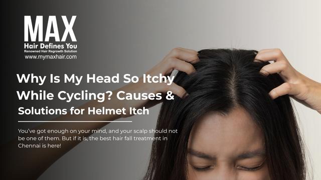 Why Is My Head So Itchy While Cycling? Causes & Solutions for Helmet Itch Image