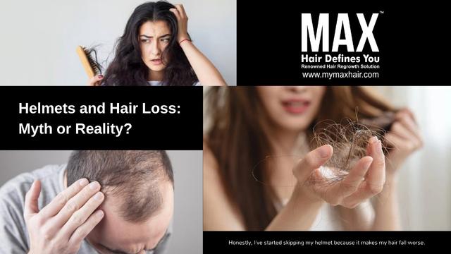 Helmets and Hair Loss: Myth or Reality? Image