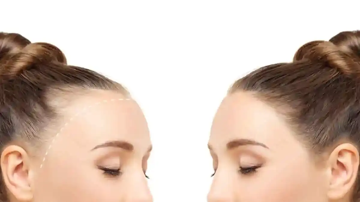 MasterBlogImage