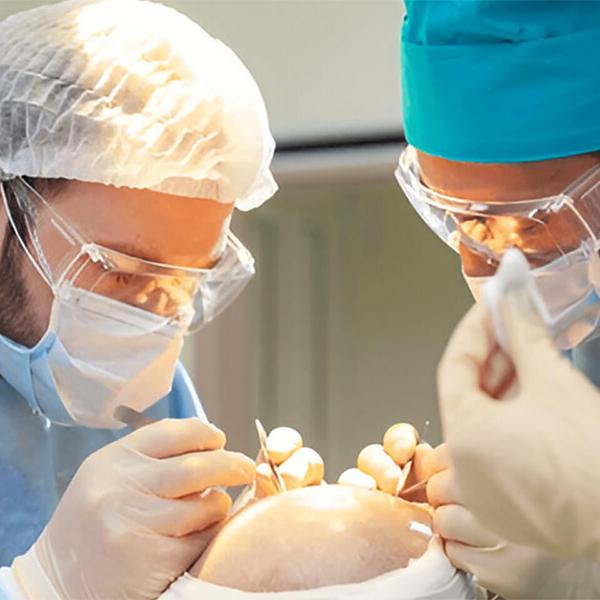 DHI Hair Transplant