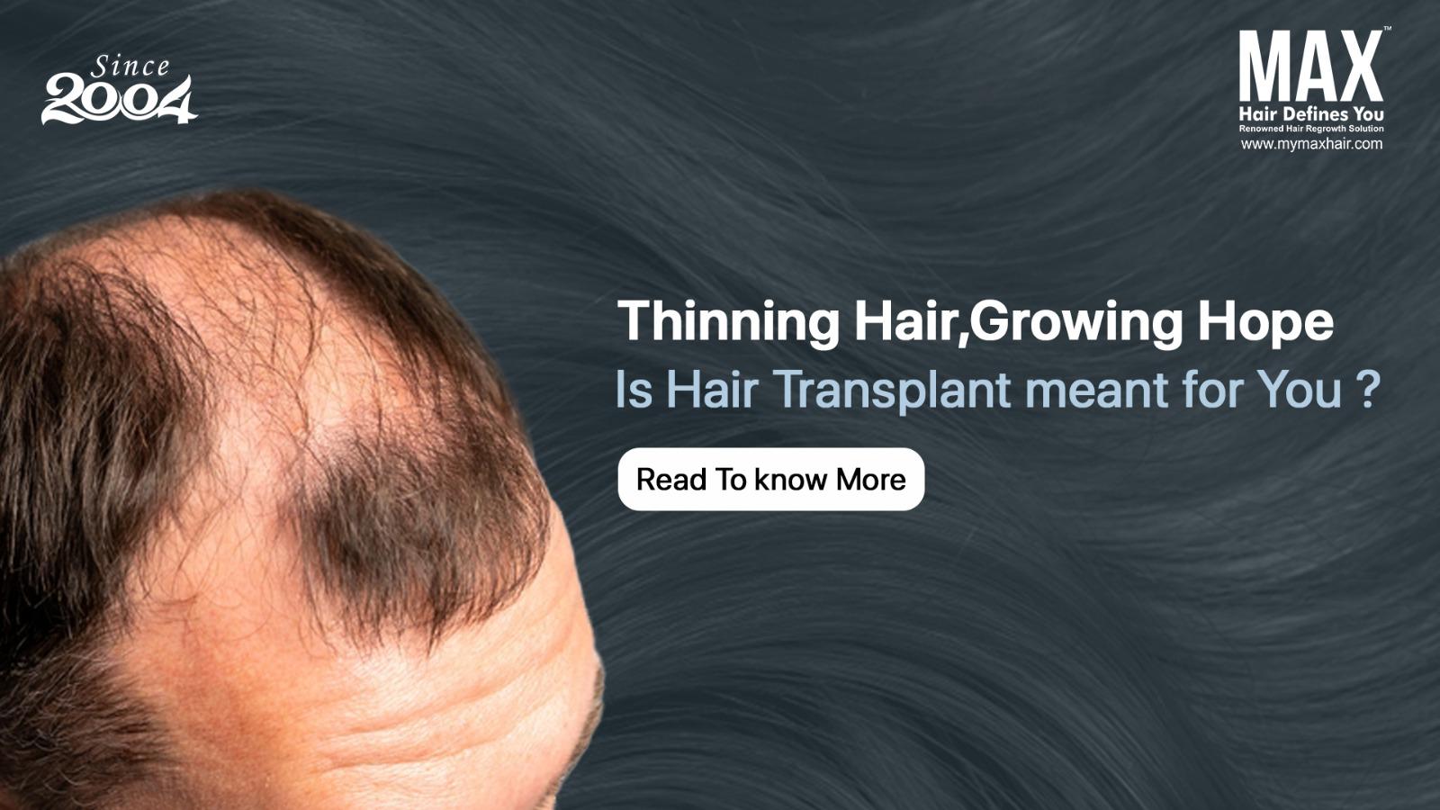 Hair Transplant Clinic 