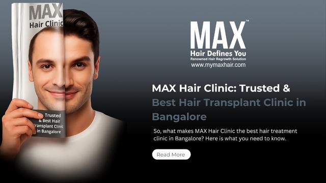 MAX Hair Clinic: Trusted & Best Hair Transplant Clinic in Bangalore Image