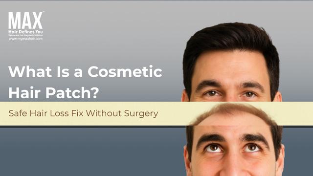 What Is a Cosmetic Hair Patch? Safe Hair Loss Fix Without Surgery Image