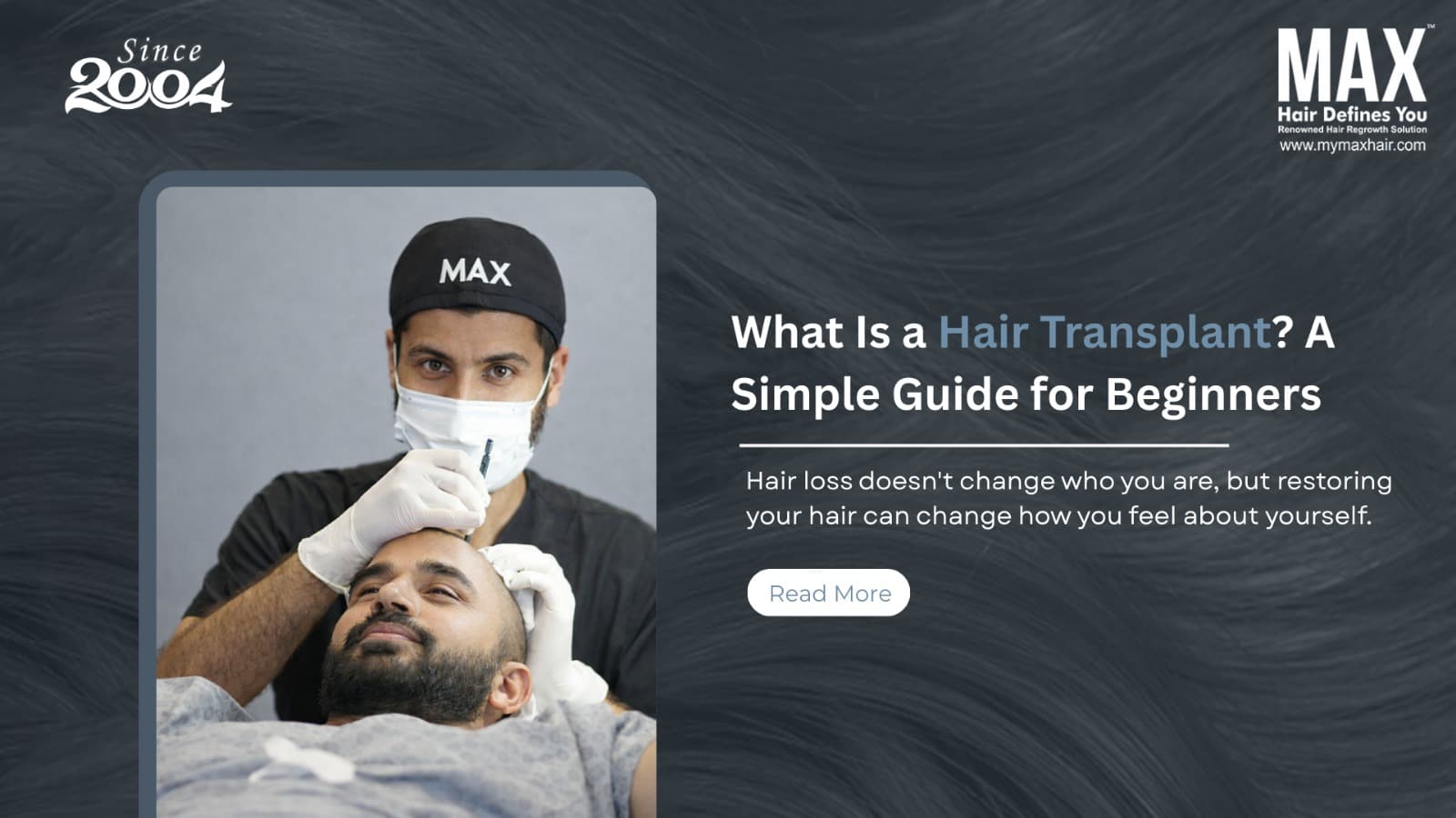 hair loss treatment in chennai