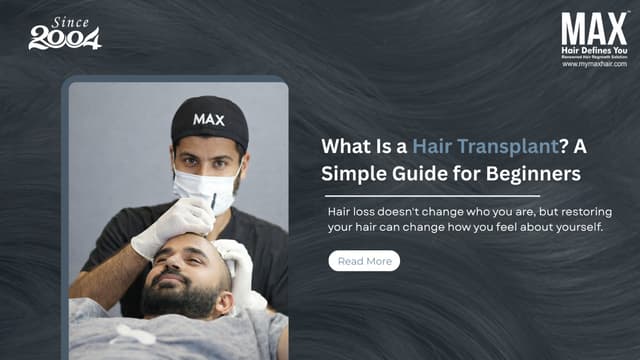 What Is a Hair Transplant? A Simple Guide for Beginners Image