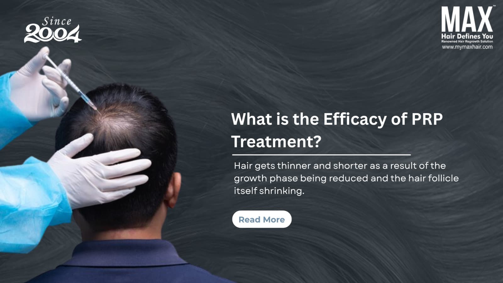 PRP Hair Loss Treatment in Chennai