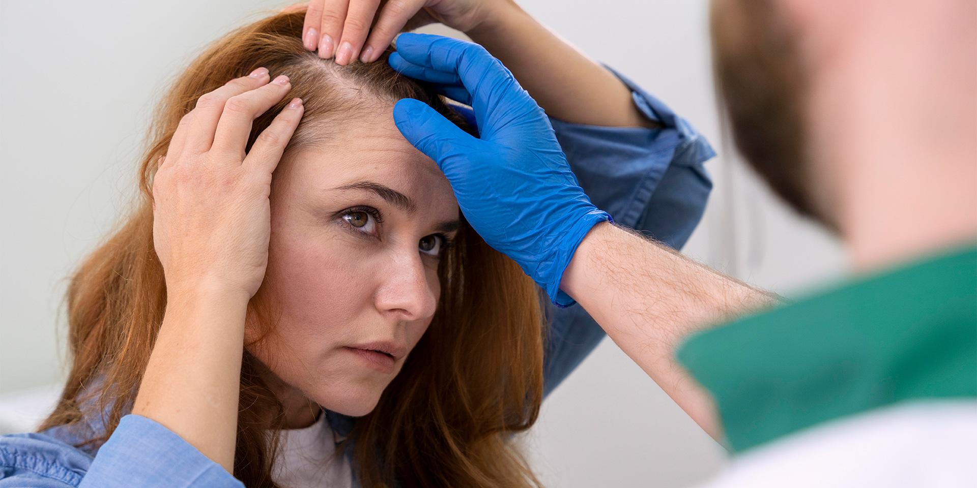 Women Hair Transplant