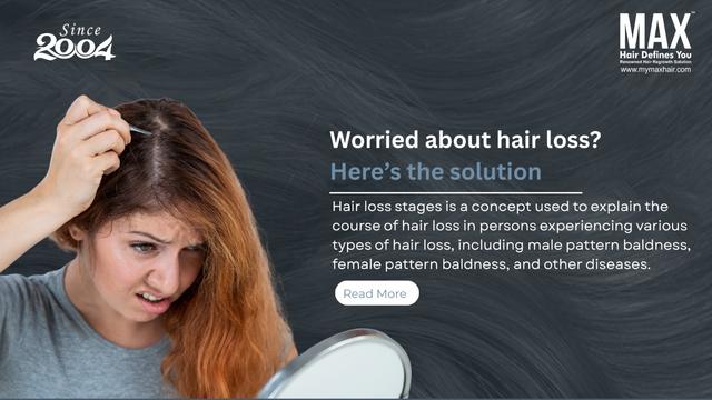 Worried about hair loss? Here’s the solution Image