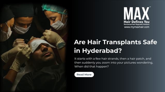 Are Hair Transplants Safe in Hyderabad? Image
