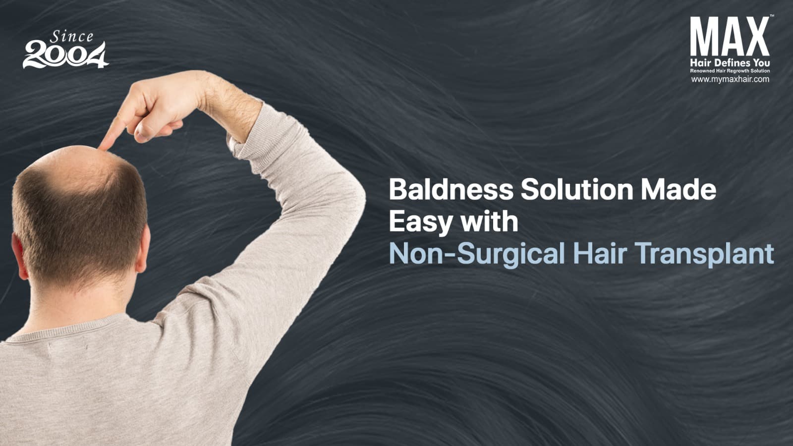 best non-surgical hair transplant chennai Non-Surgical Hair Transplants