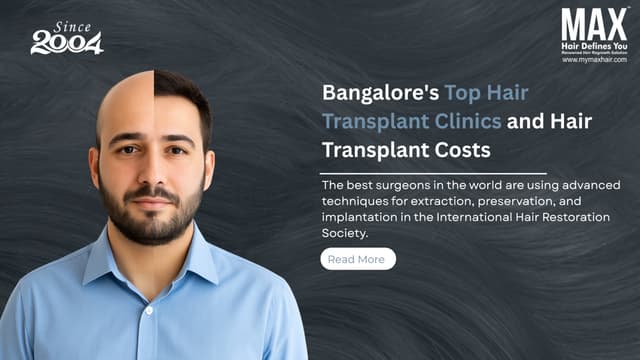 Bangalore's top hair transplant clinics and hair transplant costs Image
