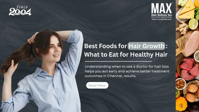 Best Food for Hair Growth: What to Eat for Healthy Hair Image