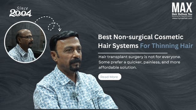 Best Non-surgical Cosmetic Hair Systems for Thinning Hair Image
