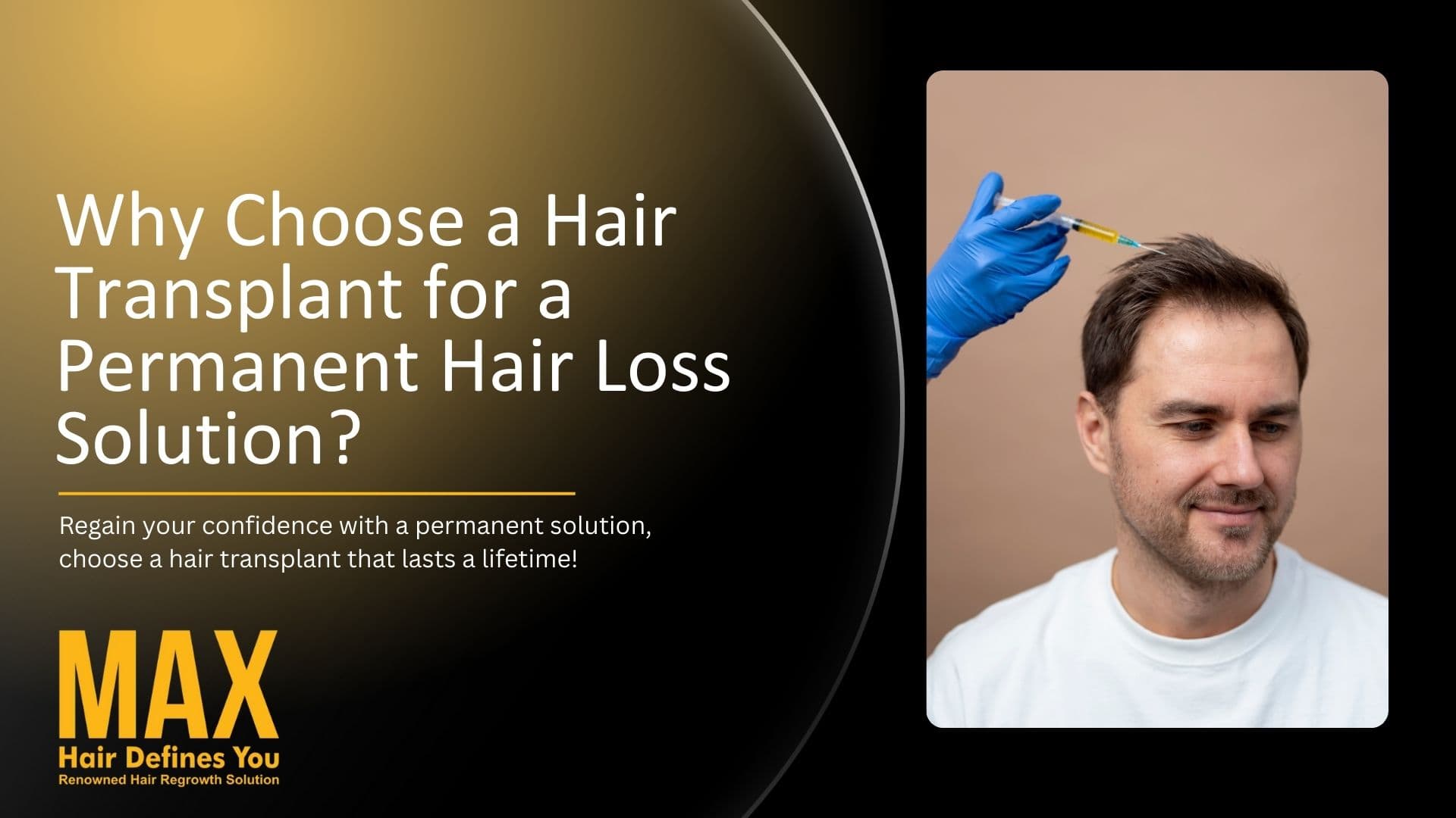 Why Choose a Hair Transplant for a Permanent Hair Loss Solution? BlogImage