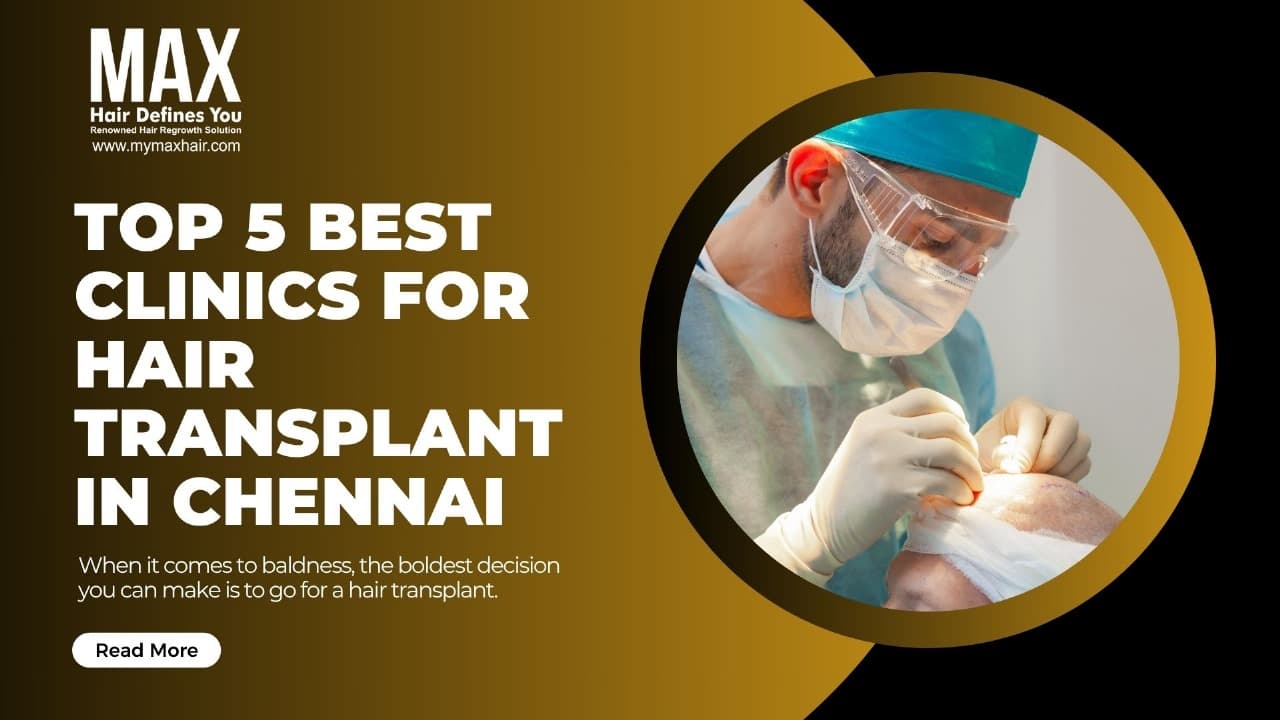 Top 5 Best Clinics for Hair Transplant in Chennai BlogImage