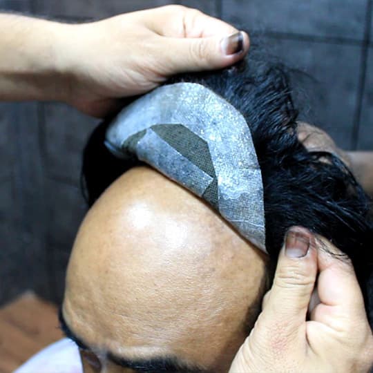 Cosmetic Hair System