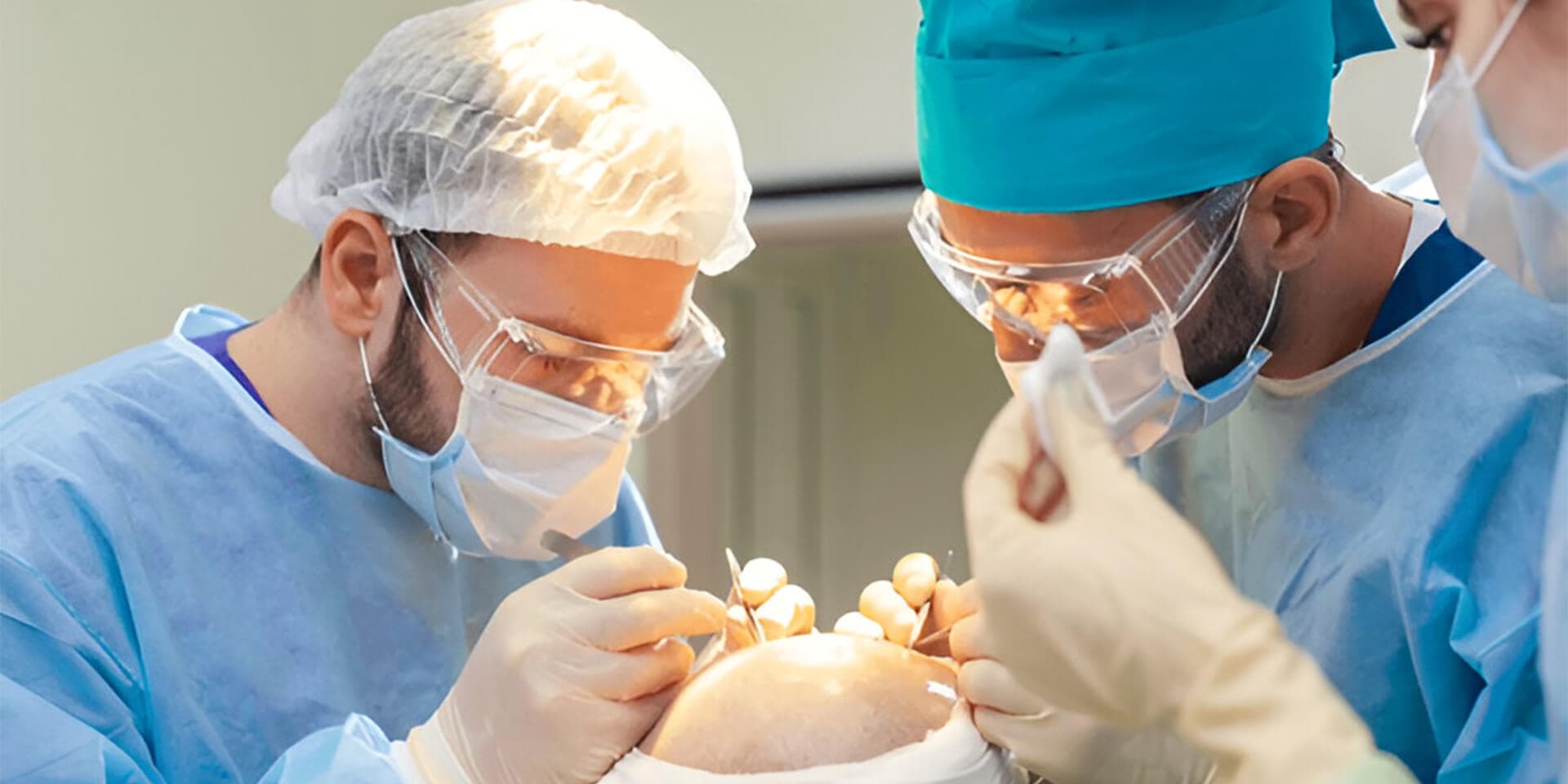 Direct Hair Transplant