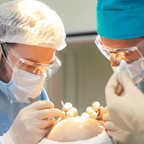 Direct Hair Transplant