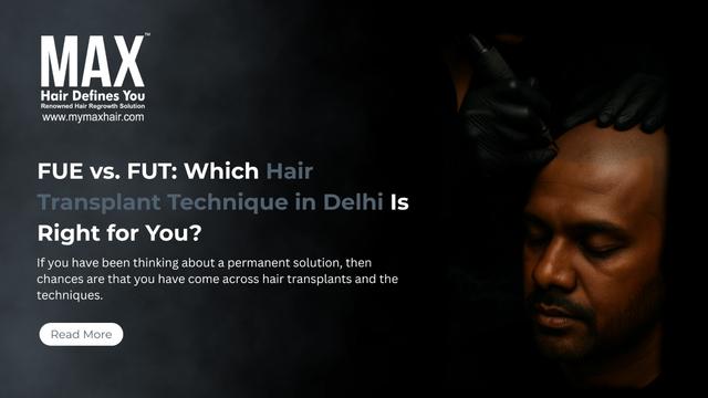 FUE vs. FUT: Which Hair Transplant Technique in Delhi Is Right for You? Image