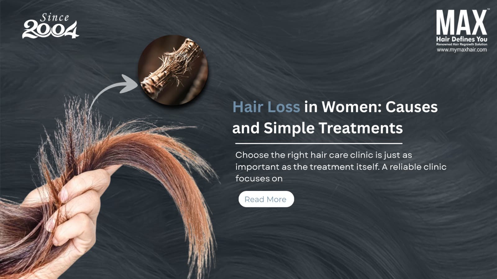 best hair loss clinic in delhi hair loss treatment in delhi
