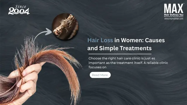 Hair Loss in Women: Causes and Simple Treatments Image