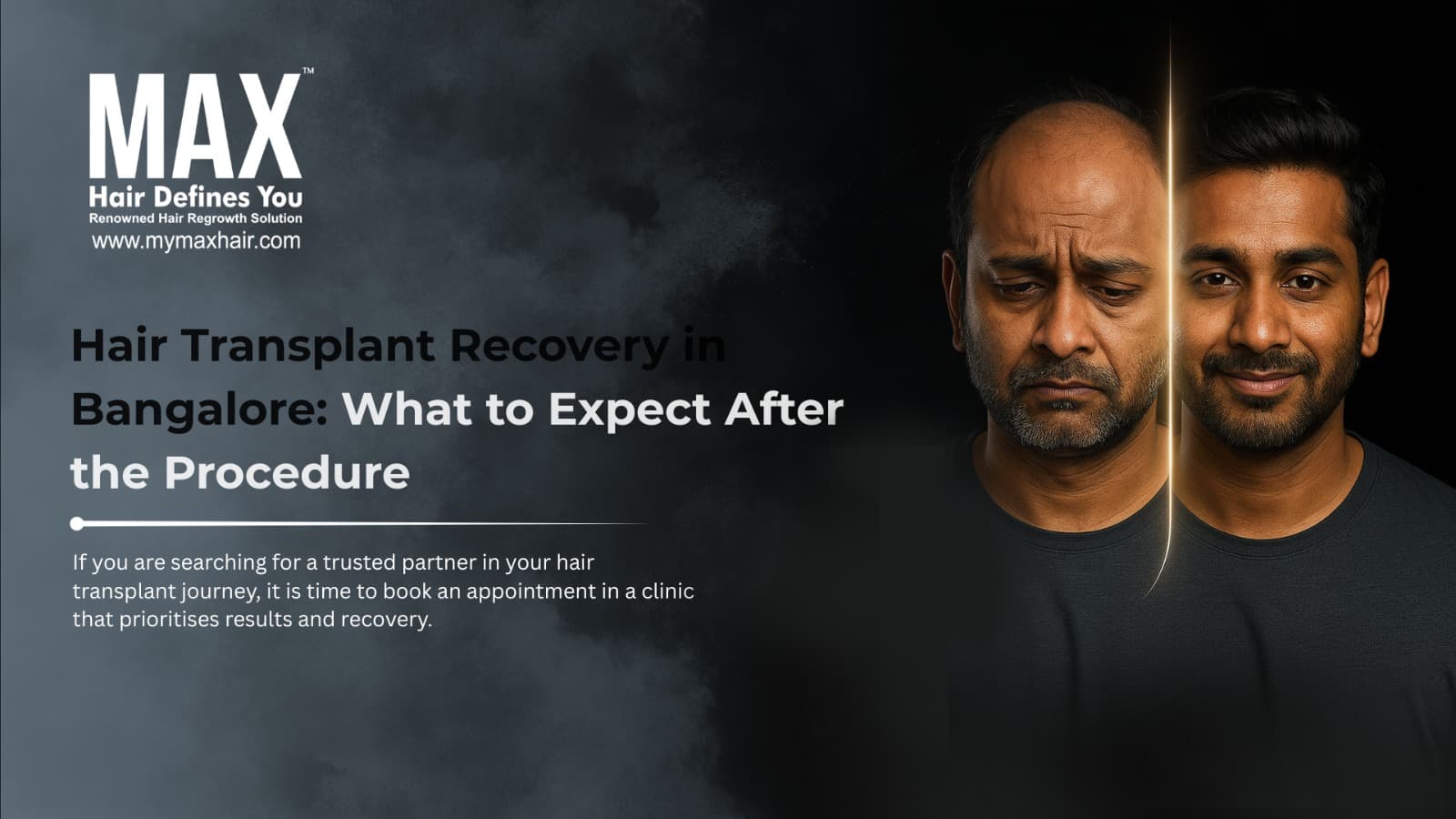 hair transplant clinic in bangalore Hair Transplant Recovery in Bangalore