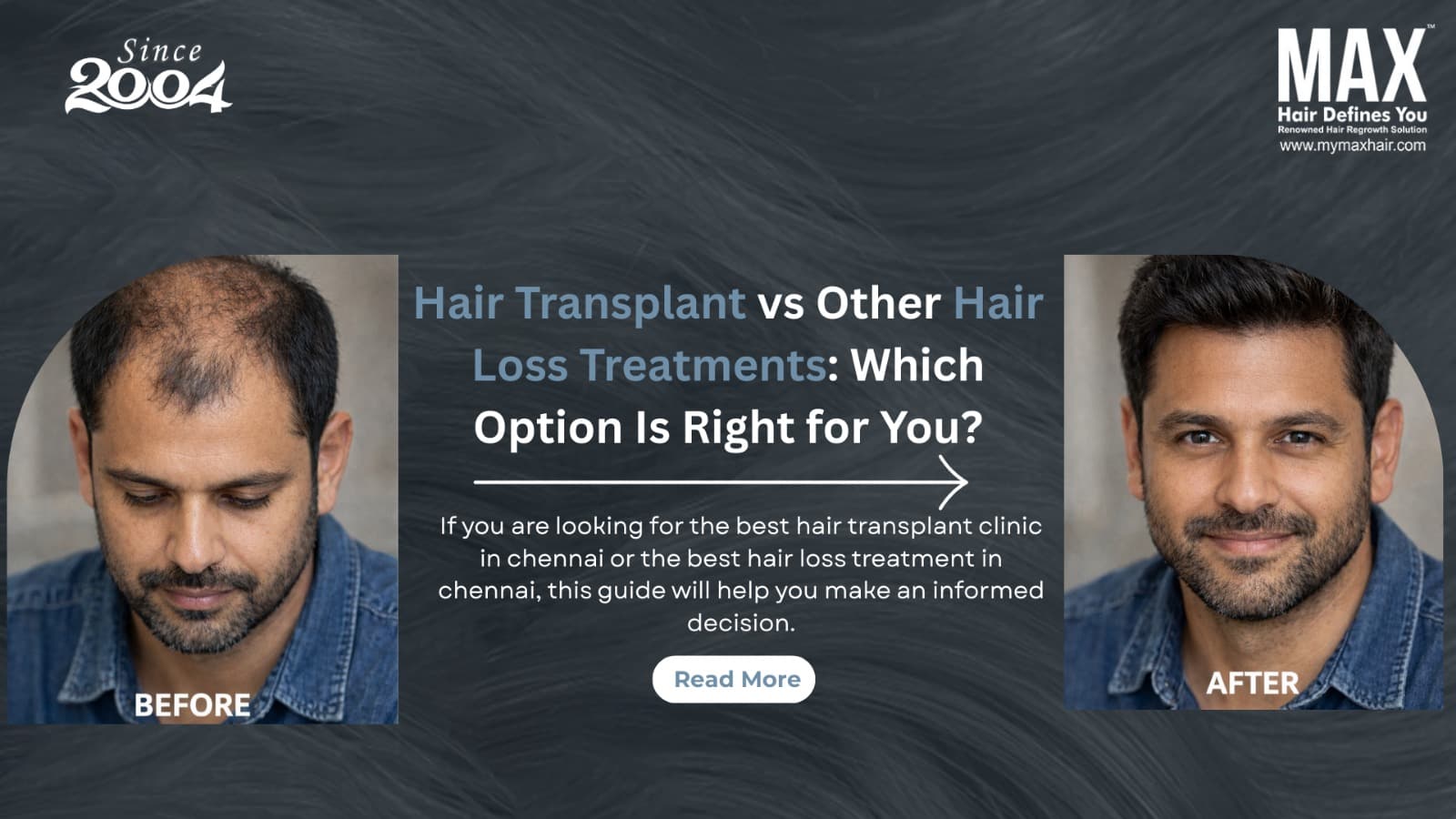 best hair care clinic in chennai best hair transplant clinic in chennai