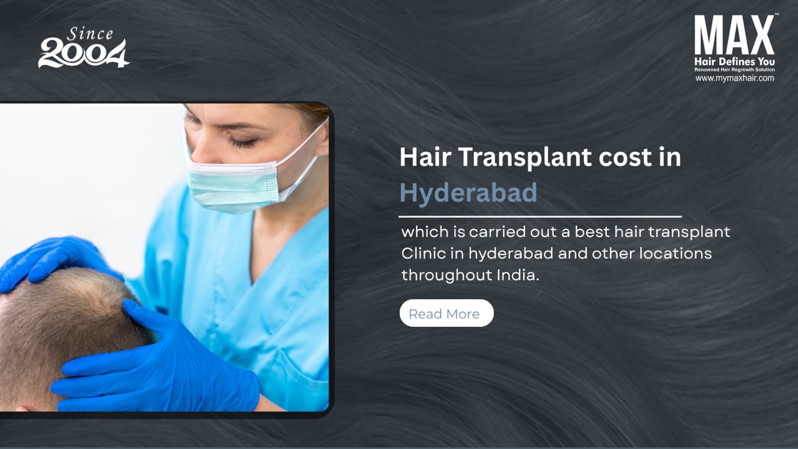 Hair transplant clinic in hyderabed Hair Transplant Cost in Hyderabad