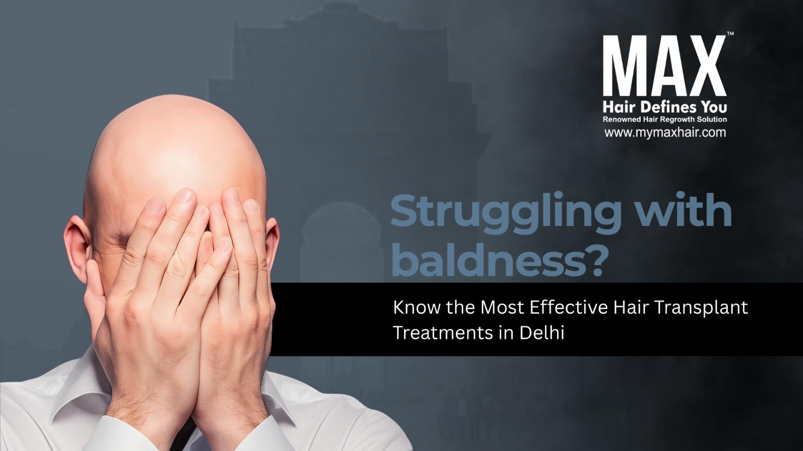 FUT hair transplant Delhi Best Hair Transplant Treatments in Delhi