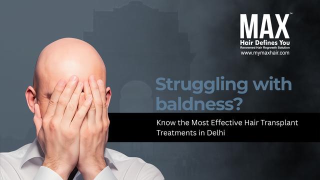 Struggling with baldness? Know the Most Effective Hair Transplant Treatments in Delhi Image