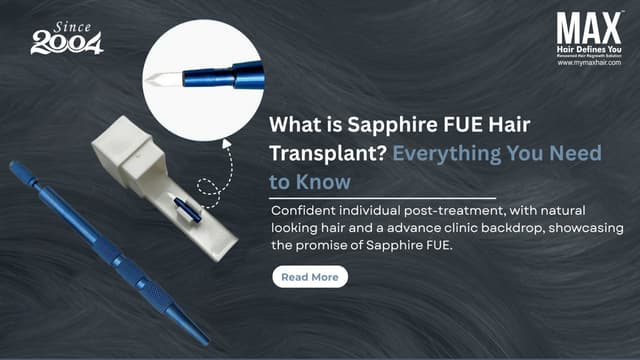 What is Sapphire FUE Hair Transplant? Everything You Need to Know Image