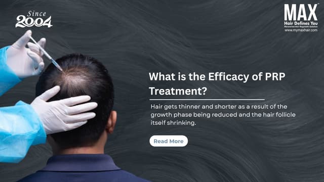 What is the Efficacy of PRP Treatment? Image